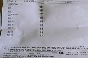 宜昌妇科医院检查HPV(宜昌长江医院是正规医院吗)